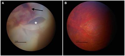 Case report: Evaluation of head trauma in a tawny owl (Strix aluco) with advanced imaging diagnostic, FVEP and BAER test